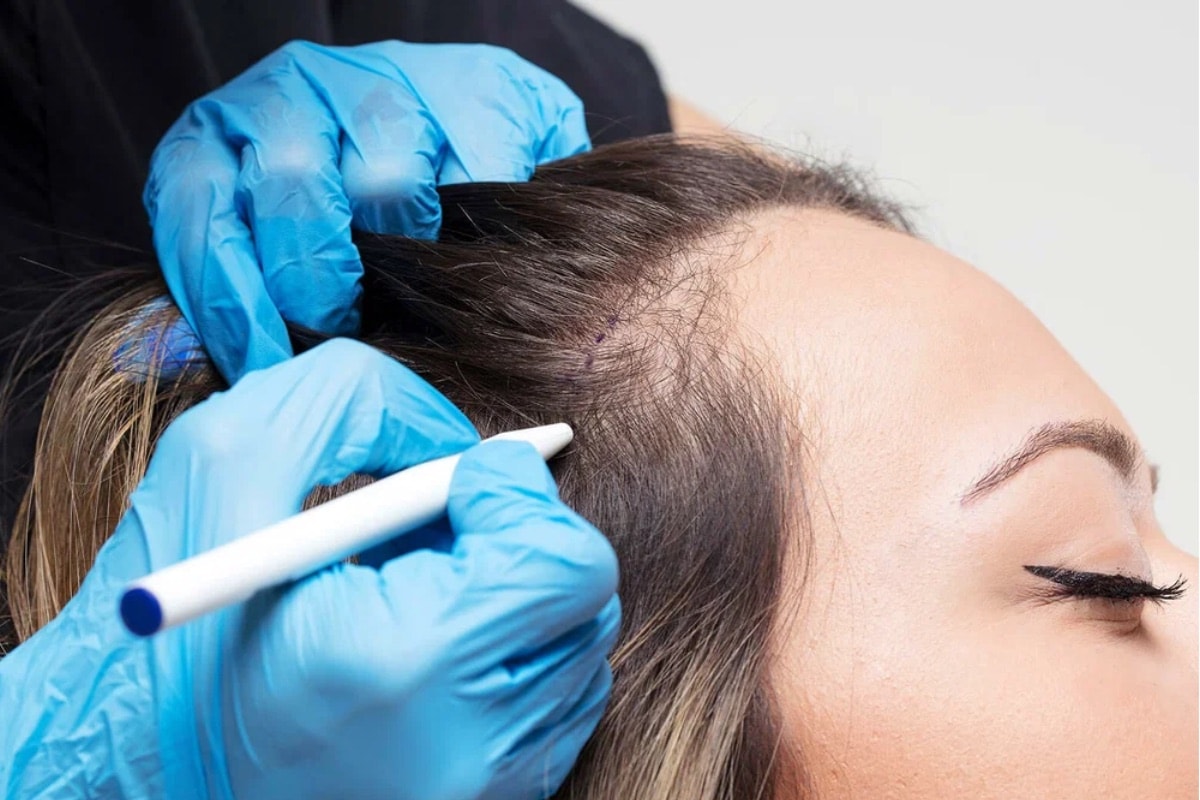 Illustrative private consultation for women’s thinning hair