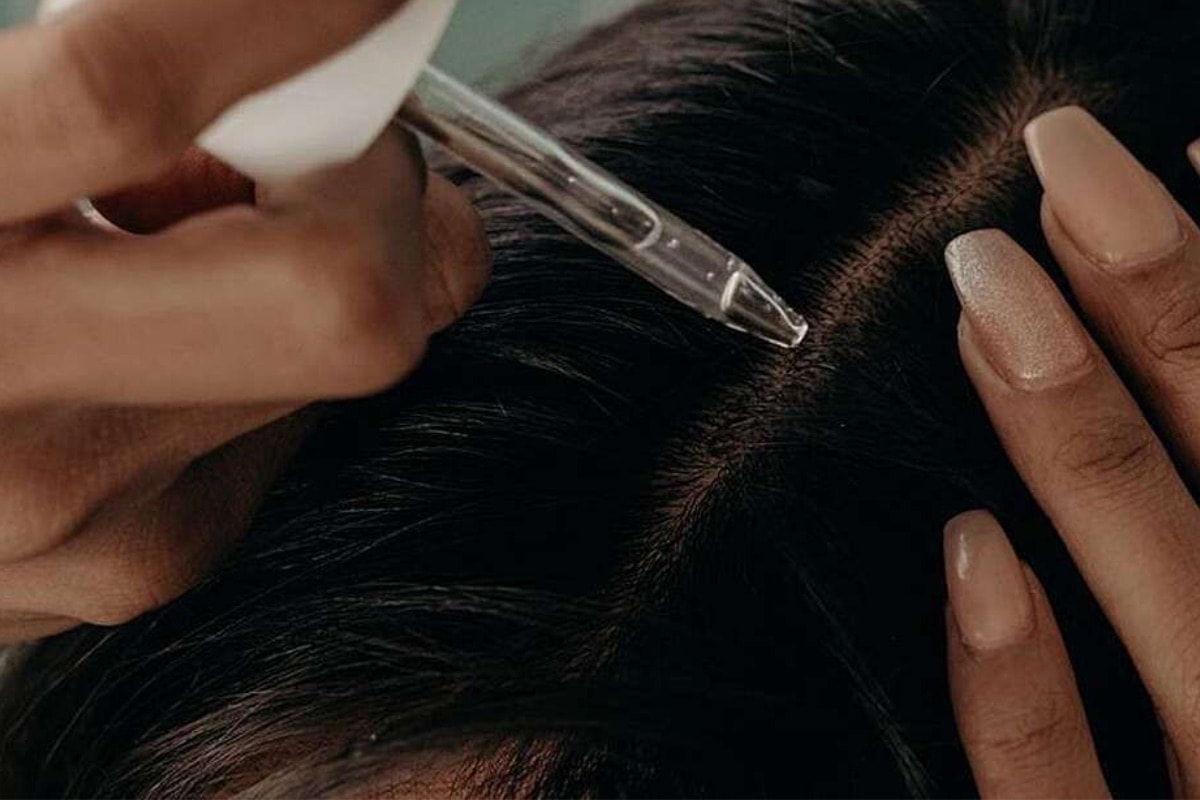 Illustrative close-up of density scalp micropigmentation planning